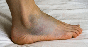 Swollen Bottom Courses Usually End The Repair Conversation